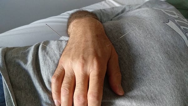 כתף קפואה – מידע וסיפור מקרה כתף קפואה – מידע וסיפור מקרה