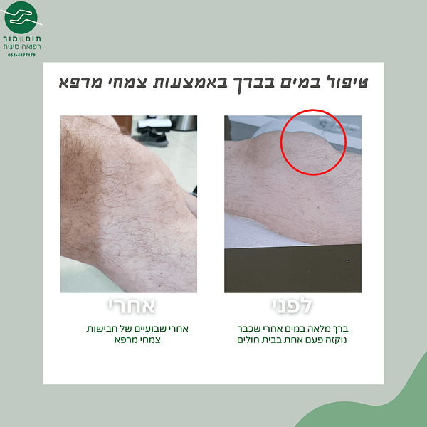 מים בברך מים בברך